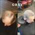 THICK FIBER Hair Fibers for Thinning Hair & Bald Spots (GRAY) - 25g Bottle, Conceals Hair Loss in Seconds, Hair Powder