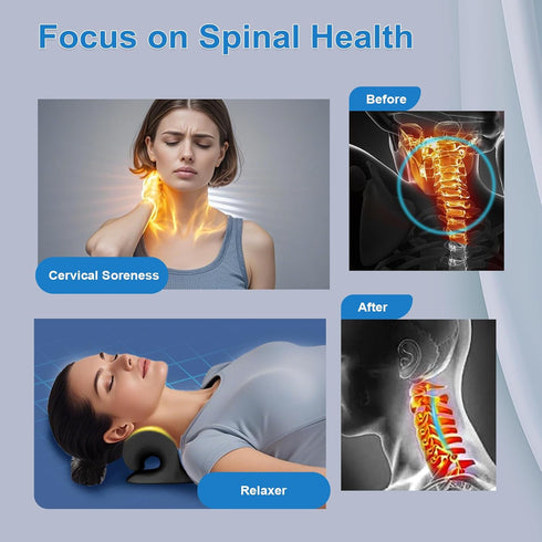 YooYuan Neck Stretcher with Magnetic Therapy Acupressure for Pain Relief, Neck and Shoulder Relaxer, Chiropractic