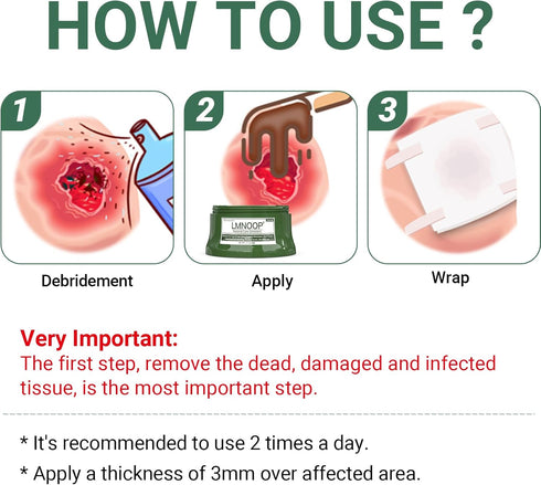 Perianal Repair Ointment: Treatments for Anal Fistula, Anal Fissure, Perianal Abscess, Rapid Relief from Pain, Burning