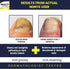 Nail Clarifying Gel, Clinically Proven for Discolored and Damaged Toenails, Effective Treatment