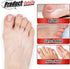 20 Pieces Toe Sleeves, Gel Toe Protectors, Breathable Toe Covers for Bunion Overlap Toe Hammer Toes Pain Relief (Skin