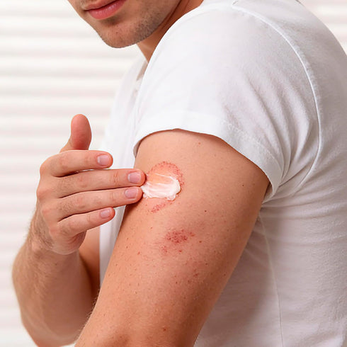 Kerova 2% (3.5 Antifungal Cream for Jock Itch, Athletes Foot & Ringworm - Miconazole Nitrate Cream for Humans Skin