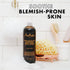 SheaMoisture Soothing Body Wash for Acne Treatment, African Black Soap, 13 Fl Oz