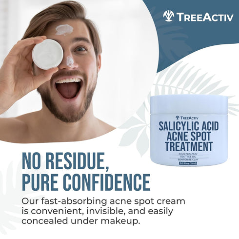 TreeActiv Invisible Acne Spot Treatment, 150+ Treatments with Salicylic Acid & Tea Tree Oil for Cystic Acne