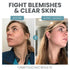 Vitamin C Serum for Face - Skin Clearing Serum with Salicylic Acid, Retinol, Niacinamide, and Hyaluronic Acid (1 oz)