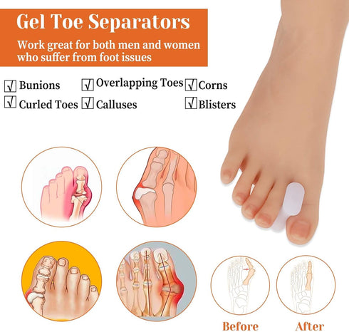 12Pcs Gel Toe Separators, Soft Toe Spacers, Bunion Corrector Pads for Men and Women, Pain Relief