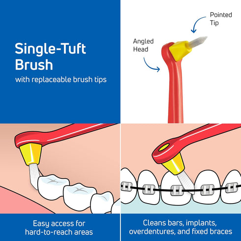 TEPE Interspace Angled Soft Toothbrush for Braces with Single-End Tuft and Removable Head, 12 Pack.