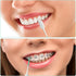 Green Soft Silicone Interdental Brush, Disposable Braces Brush, 160pcs Corrective Cleaning Tools for Teeth Health
