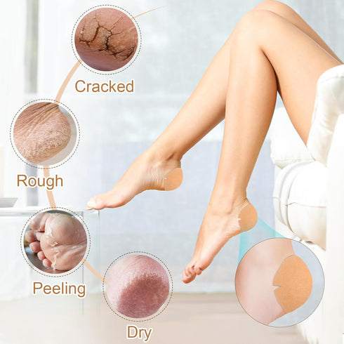TEAWOO 30PCS (80mm 80mm) Patented Cracked Heel Treatment Patches, Cracked Heel Repair Bandage x