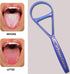 Tongue Scraper Cleaner, End Bad Breath, Freshens Breath - Effective Bad Breath Treatment (Color May Vary)