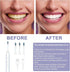 MISTYFRESH 6 Sonic Electronic Toothbrush with Modes and Smart Timer Perfect for Men and Women Clean Teeth and Gums