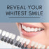 Teeth Whitening Gel Refill for Trays - Professional Strength 44% Carbamide Peroxide Formula for a Brighter Smile