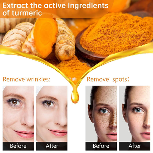 Turmeric Serum for Dark Spots, 1 Fl Oz, Anti Aging Facial Serum for Face & Body, Reduces Hyperpigmentation