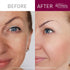 Retinol Cream Cleanser - 5oz Anti-Aging Daily Deep Cleansing Facial Wash for Softer Skin