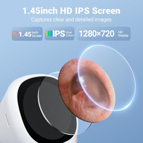 ScopeAround 1.45" 3.9mm 6 Otoscope with Light, IPS Display Digital Otoscope, Ear Camera with Ear Wax Removal Tools, Ear