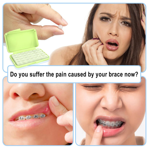 BVN Braces Wax Dental Wax: 10 Boxes Orthodontic Wax Strips for Braces, Tooth Wax for Relief