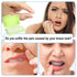 BVN Braces Wax Dental Wax: 10 Boxes Orthodontic Wax Strips for Braces, Tooth Wax for Relief
