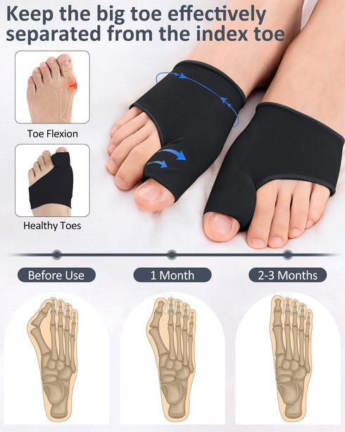 2 Pcs Bunion Corrector for Women Men, Breathable Bunion Correction Socks with Built-in Gel Pad