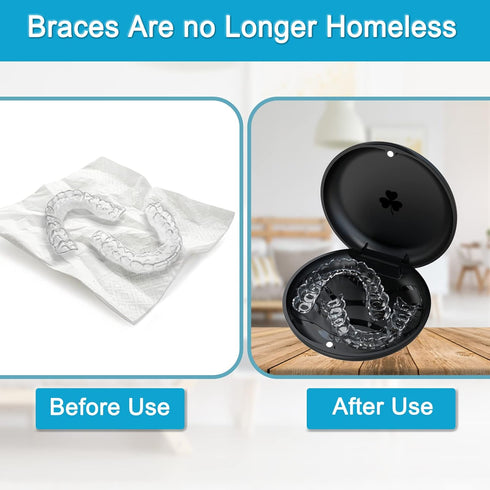 2 Pack Aligner and Retainer Case - ARGOMAX Slim Case Compatible with Invisalign and Orthodontic Storage Holder