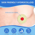 THUJPKU 20 2mm 2mm PCS Ostomy Barrier Rings, Moldable Ostomy Supplies, Flexible Medical Grade Hydrocolloid Ostomy Bag