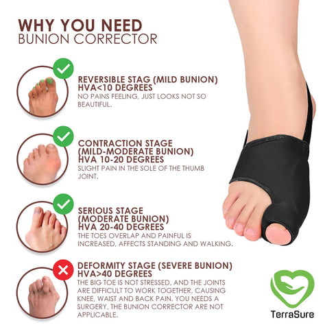 Bunion Corrector with Splint, Effective Orthopedic Toe Separators for Women & Men, Pain Relief for Hallux Valgus (Black)