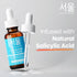 SeoulCeuticals Korean Acne Serum 1oz - Skin Care Treatment for Acne Prone Skin with Salicylic Acid, Tea Tree & Clove