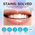 Venus Visage Dazzle Dust Teeth Whitening Powder, 40 g - Enamel-Friendly Tooth Powder for Stain Removal