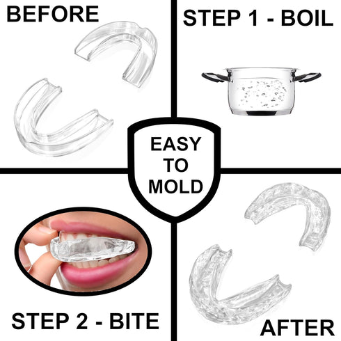 Mouth Guard for Women, Custom Fit Moldable, (2) Guards for Teeth Grinding & Case, Comfortable Dental Guard