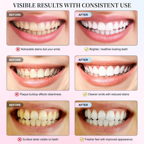 Rulviou Niacinamide Whitening Toothpaste - Fresh Breath,Brightening,Deep Gentle Cleaning Tooth Paste, Boosting Gum