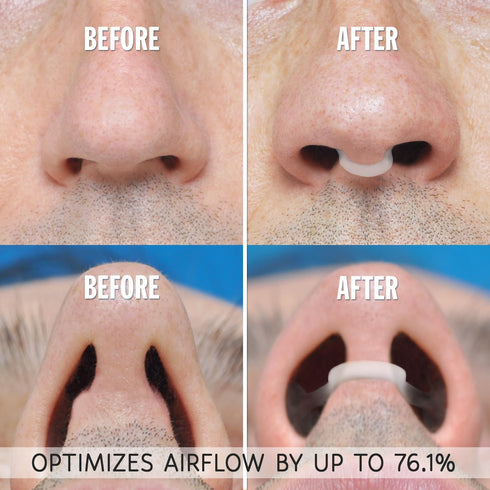 AIRMAX Medium Clear Nasal Dilator for Better Sleep, Comfortable Anti Snoring Device