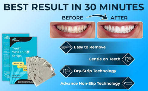 ZAFiNCO 28 Recommended,-Non 14 Teeth Whitening Strips for a Brighter Smile - Mint Flavored Sensitive Teeth Whitening