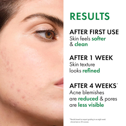 VICHY Normaderm Acne Control Daily Moisturizer, Oil Free Acne Moisturizer for Face, Max Strength 2% Salicylic Acid +