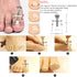 JTIEO 9 Pack Toenail Clippers, Ingrown Toenail Removal Kit, Heavy Duty Tools for Seniors, Black
