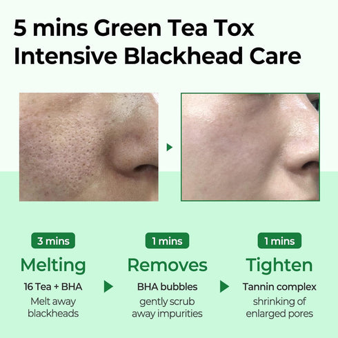 SOME BY MI Bye Bye Blackhead 30 Days Miracle Green Tea Tox Bubble Cleanser, 4.23 Oz