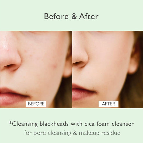 Cica Pore Cleansing Foam | Daily Face Wash for Pore Cleansing & Sebum Control | Cica, Hyaluronic Acid, Aloe (4.05 fl.