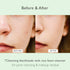 Cica Pore Cleansing Foam | Daily Face Wash for Pore Cleansing & Sebum Control | Cica, Hyaluronic Acid, Aloe (4.05 fl.