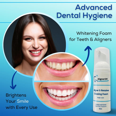 Aligner Cleaning Foam, Whitening Retainer Cleaner Foam - Can Substitute Toothpaste for a Brighter Smile
