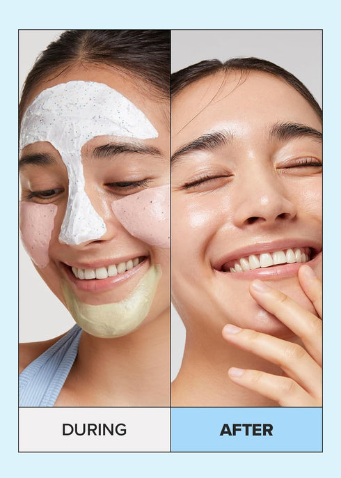 I DEW CARE Wash-off Masks with Headband Set - Scoop Party | Gift Set with Hyaluronic Acid, Skincare Essentials,