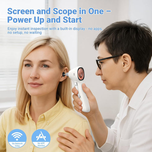 ScopeAround 1.45" 3.9mm 6 Otoscope with Light, IPS Display Digital Otoscope, Ear Camera with Ear Wax Removal Tools, Ear