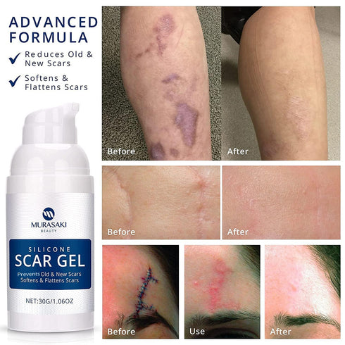 100% Silicone Scar Gel, Advanced Scar Cream for Surgical Scars, C-Section, Stretch Marks, 1.06oz (30g)