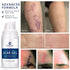 100% Silicone Scar Gel, Advanced Scar Cream for Surgical Scars, C-Section, Stretch Marks, 1.06oz (30g)
