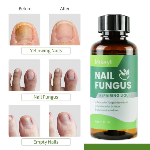 NOXYRAL 7 Toenail Fungus Treatment Extra Strength: Pure Natural Plant ExtractsToe & Fingernail Fungus Renewal - Nail