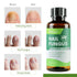 NOXYRAL 7 Toenail Fungus Treatment Extra Strength: Pure Natural Plant ExtractsToe & Fingernail Fungus Renewal - Nail