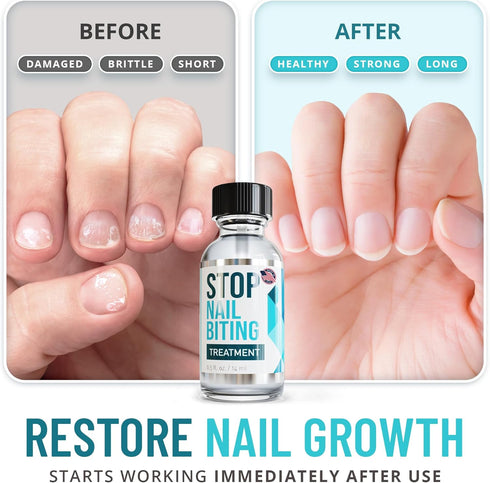 Stop Nail Biting Treatment, Clear Bitter-Tasting Nail Polish for Healthy Nail Growth (0.5 fl oz)
