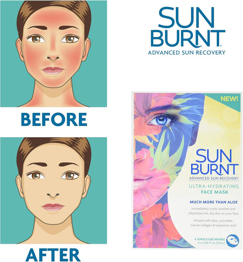 Sunburnt Ultra-Hydrating Face Sheet Mask, Advanced Sun Recovery, Treat Dry Sun Damaged Skin, For After Sun Exposure, Much More than Aloe, Soothes and Rehydrates Hot Dry Skin (4 single use masks)