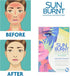 Sunburnt Ultra-Hydrating Face Sheet Mask, Advanced Sun Recovery, Treat Dry Sun Damaged Skin, For After Sun Exposure, Much More than Aloe, Soothes and Rehydrates Hot Dry Skin (4 single use masks)