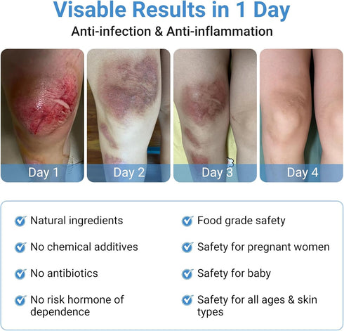 LMNOOP Wound Care Ointment - Fast Healing Wound Cream, Maximum Repair for All Ages, Wound Healing Ointment