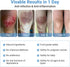 LMNOOP Wound Care Ointment - Fast Healing Wound Cream, Maximum Repair for All Ages, Wound Healing Ointment