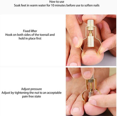 Ingrown Toenail Lifter, Stainless Steel Nail Corrector Tool for Curved Ingrown Toenails, Foot Care Pedicure Tool (Gold)