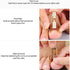 Ingrown Toenail Lifter, Stainless Steel Nail Corrector Tool for Curved Ingrown Toenails, Foot Care Pedicure Tool (Gold)